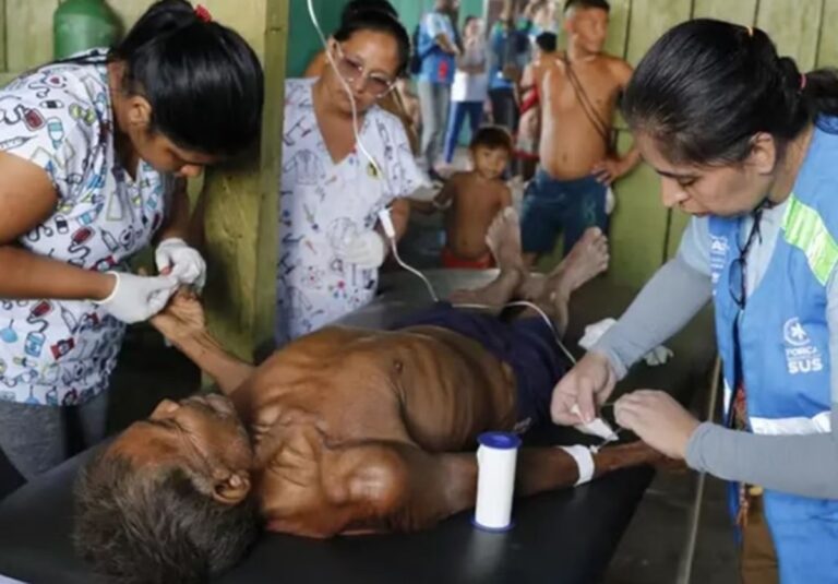 Brasil registra quase 3 mil mortes de Yanomami em 10 anos brasil-registra-quase-3-mil-mortes-de-yanomami-em-10-anos